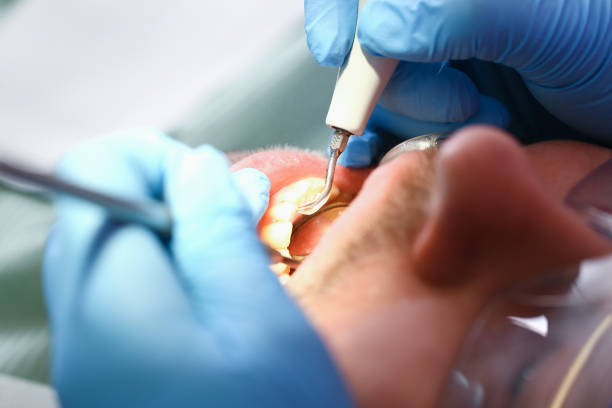 Best Teeth Whitening  in Kalaheo, HI