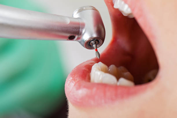 Best Tooth Infection Emergency Dentist  in Kalaheo, HI